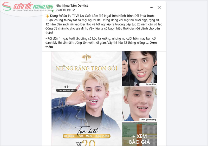 Marketing nha khoa qua Facebook Ads Marketing nha khoa qua Facebook Ads